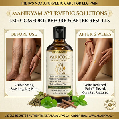 VARICOSE VEINS PAIN RELIEF OIL - Ayurveda Oil Relief 60 Days Challenge-250ML