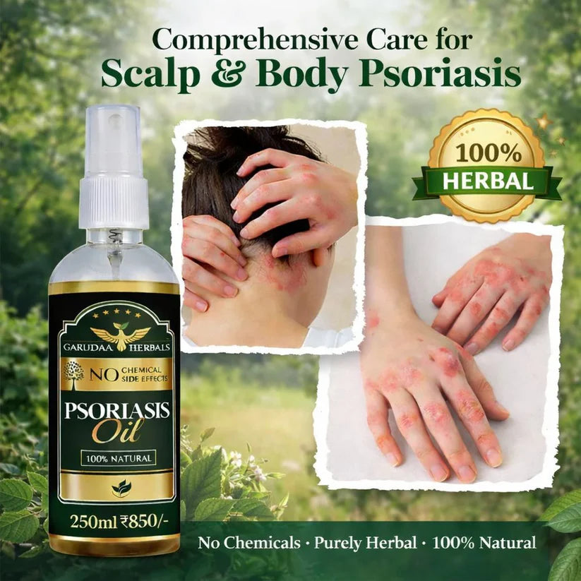 Ayur Herbal Psoriasis -Clearing Oil-250ML